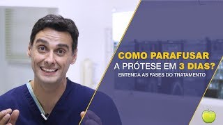 Parafusar a Prótese com Implantes logo após a Cirurgia ou Não Entenda as Fases do Tratamento [upl. by Melak664]