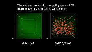 Axonopathic varicosities Analysis using Binaree Tissue clearing kit [upl. by Tanberg]