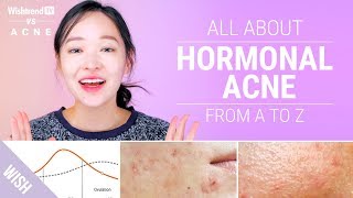 How to Cure Hormonal Acne  Lifestyle amp Skincare Tips  Wishtrend TV VS ACNE [upl. by Klepac]