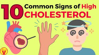 10 Common Signs of High CHOLESTEROL You SHOULD NOT Ignore  VisitJoy [upl. by Sacrod]