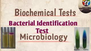 Biochemical Tests ll Bacterial Identification test ll Microbiology [upl. by Yrogiarc]