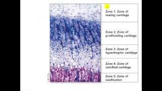 Bone Growth and Remodeling Appositional and Interstitial Growth [upl. by Adur946]