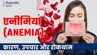 Anemia Symptoms Causes And Treatment In Hindi  शरीर में खून की कमी यानी Anemia कितना ख़तरनाक है [upl. by Fee]