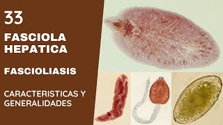 FASCIOLA HEPÁTICA 33  FASCIOLIASIS  TREMATODOS [upl. by Ahsielat]