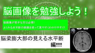 無料で簡単！脳画像の勉強「脳梁膨大部の見える 水平断編」【超簡単解説】 [upl. by Carine]