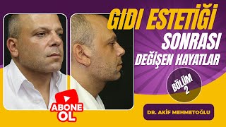 Gıdı estetiği sonrası değişen hayatlar 2 I DR AKİF MEHMETOĞLU [upl. by Ernesto]