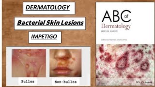 DERMATOLOGY Bacterial skin lesions  impetigo bullos nonbullos ecthyma derma impetigo [upl. by Aihtak]