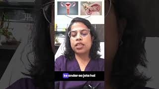 Understanding Ectopic Pregnancy in Hindi [upl. by Talia]