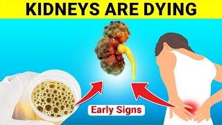 5 Early Signs of Kidney Damage You Must Not Ignore [upl. by Kcirrad]