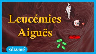 🎗️ Leucémie Aigue 🩸  symptômes🤧 traitements💉  Résumé  Hématologie [upl. by Ruff600]