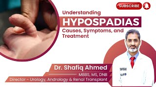 Understanding Hypospadias Causes Symptoms and Treatment  Dr Shafiq Ahmed Hypospadias prostate [upl. by Brunella]