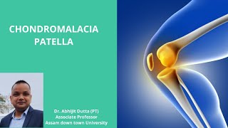 CHONDROMALACIA PATELLA [upl. by Ambrose]