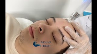 How to Do a Professional Facial Treatment w 3rd Gen 7 in 1 Professional Hydro Dermabrasion Machine [upl. by Euqinomod666]