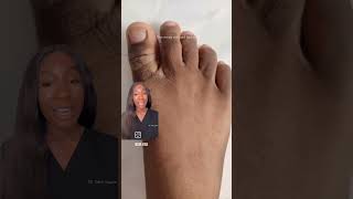 Foot careDr explained 🤌👌skincare beauty [upl. by Maharg195]