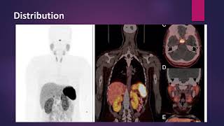 Neuroendocrine Tumors imaging with Ga 68 Somatostatin analogs MCQ nuclearmedicineMCQ [upl. by Ecylahs]