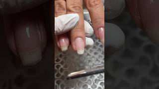 Nail Repair😍 nailrepair nailfix brokennail nailtutorial nailtips manicuretutorial nails [upl. by Ellohcin]