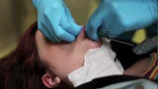 6g labret piercing procedure [upl. by Garrot]