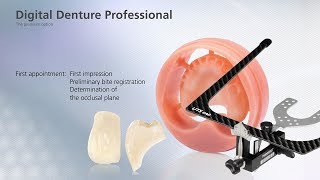 Digital Denture – first Appointment [upl. by Esme]