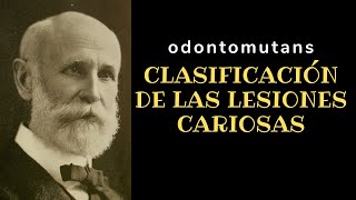 CLASIFICACIÓN DE LAS LESIONES CARIOSAS BLACK MOUNT Y HUME [upl. by Orestes793]