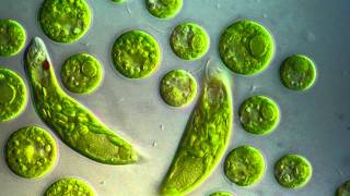 Chlamydomonas amp Euglena viridis [upl. by Sakul]