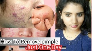 How To Remove Pimples Overnight  5 ways  Tamil beauty tips [upl. by Mcmath]