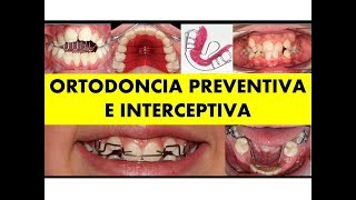 quotORTODONCIA PREVENTIVA E INTERCEPTIVAquot por el Dr Luis Arroyo [upl. by Rimaj]