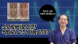 소아마비 후유증으로 인한 여성 짝다리 교정 사례입니다  보니따클리닉정광섭 원장 [upl. by Enillebyam]