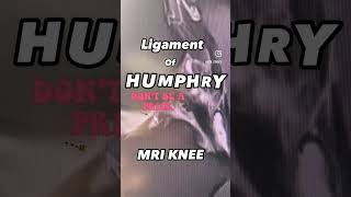 knee ligaments MRI humphrey [upl. by Nylatsyrk121]