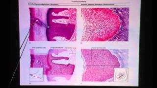 Keratinized Stratified Squamous Epithelium [upl. by Alesram]