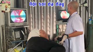 Gastroscopy for early cancer diagnosis  Nội soi dạ dày chẩn đoán ung thư sớm [upl. by Yelahs]