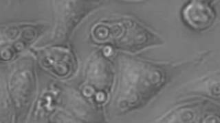 Cryptococcus neoformans migrating between macrophages [upl. by Mayne]