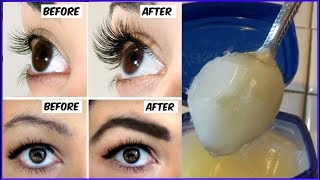 How To Grow Thicker Eyebrows amp Eyelashes In Just 14 Days  100 Working  Simple Beauty Secrets [upl. by Yehs]