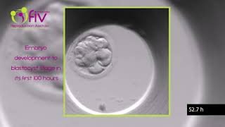 TimeLapse  Embryo development ENG first 100 hours [upl. by Latimore138]