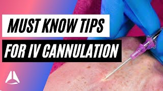 Important tips and tricks for IV cannulation [upl. by Haibot]