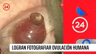 De manera inédita logran fotografiar ovulación humana  24 Horas TVN Chile [upl. by Frazer]