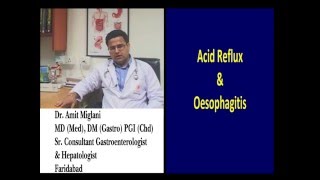 What is Gastroesophageal Reflux Disease GERD  By Dr Amit Miglani Hindi phenotics [upl. by Nnaecyoj]