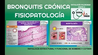 EPOC BRONQUITIS CRÓNICA FISIOPATOLOGÍA  GuiaMed [upl. by Lenor148]