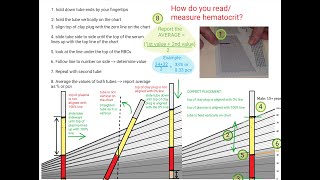 Hematocrit Review [upl. by Aynekal]