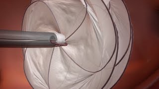 GORE® CARDIOFORM Septal Occluder PFO Animation [upl. by Schoof]