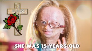 Adalia Rose Girl Who Aged Too Fast Dead at 15 [upl. by Aivek387]