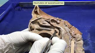 Pharynx I  Internal features [upl. by Nirek]