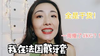 vlog 巴黎日记  我在法国带牙套  法国整牙保姆级教程  带牙套一个月效果如何？  怎么选择医生 amp 牙套种类？  一周瘦了4KG [upl. by Euphemie]