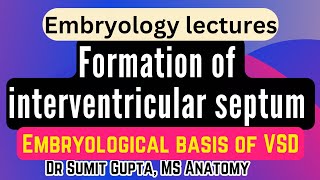 Interventricular septum  Ventricular septal defect  CVS embryology [upl. by Eicirtap]