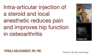 Injection of a steroid and anesthetic reduces pain and improves hip function in osteoarthritis [upl. by Tull415]