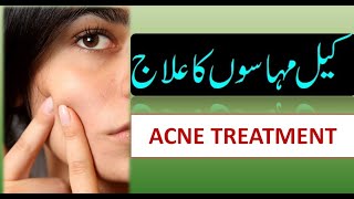 Acne Treatment in Urdu [upl. by Ramahs]