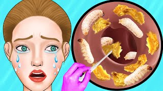 ASMR Girl Removes Maggots From Ear  ASMR Animation [upl. by Riem176]