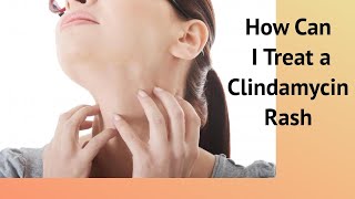 How Can I Treat a Clindamycin Rash [upl. by Dinnie]