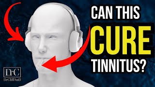 New Tinnitus Treatment Update  Bimodal Neuromodulation from Lenire [upl. by Tychonn]