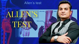 AllensTest How to perform Allens test [upl. by Belak]