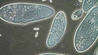 Paramecia Contractile Vacuoles by Edwin Lee [upl. by Teraj983]